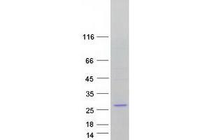Image no. 1 for Dynactin 3 (p22) (Dctn3) (Transcript Variant 1) protein (Myc-DYKDDDDK Tag) (ABIN2719849)