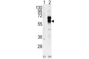 Image no. 2 for anti-Activin A Receptor Type II-Like 1 (ACVRL1) (AA 38-68) antibody (ABIN3029853)