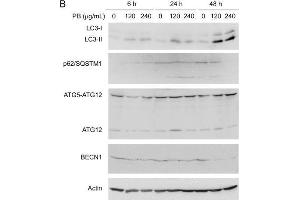 Image no. 16 for anti-Sequestosome 1 (SQSTM1) (Internal Region) antibody (ABIN2854836)