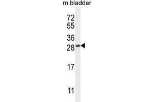 Image no. 1 for anti-TRAF-Interacting Protein with Forkhead-Associated Domain, Family Member B (TIFAB) (AA 40-70), (Middle Region) antibody (ABIN955210)
