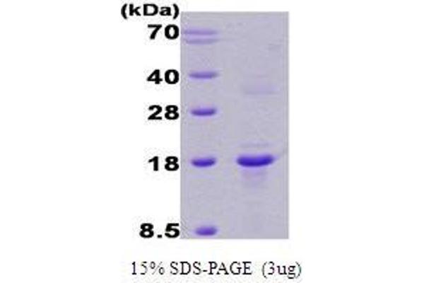 Regulator of Calcineurin 1 (RCAN1) (AA 1-117), (Isoform B) protein