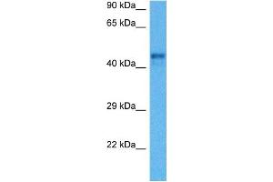 Image no. 2 for anti-Renin (REN) (C-Term) antibody (ABIN2776795)