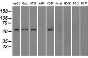 Image no. 2 for anti-Solute Carrier Family 2 (Facilitated Glucose/fructose Transporter), Member 5 (SLC2A5) antibody (ABIN2721985)