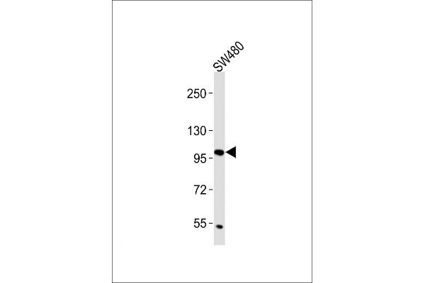 CD130/gp130 antibody  (C-Term)
