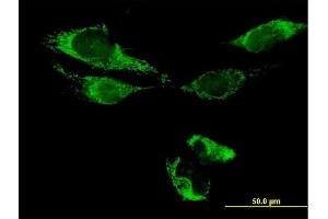 Immunofluorescence of purified MaxPab antibody to ATAD3B on HeLa cell.