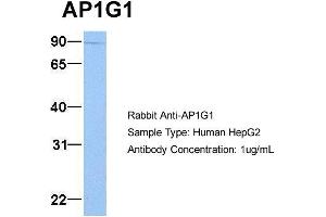 Image no. 1 for anti-Adaptor-Related Protein Complex 1, gamma 1 Subunit (AP1G1) (C-Term) antibody (ABIN2784689)