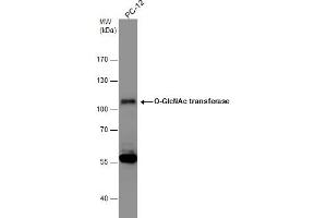 Image no. 1 for anti-O-Linked N-Acetylglucosamine (GlcNAc) Transferase (UDP-N-Acetylglucosamine:polypeptide-N-Acetylglucosaminyl Transferase) (OGT) (N-Term) antibody (ABIN2856738)