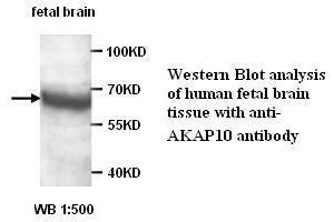 Image no. 1 for anti-A Kinase (PRKA) Anchor Protein 10 (AKAP10) antibody (ABIN6583506)