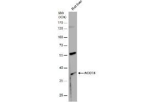 WB Image ACOT8 antibody detects ACOT8 protein by western blot analysis.