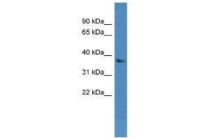 Image no. 1 for anti-Dehydrogenase/reductase (SDR Family) Member 7 (DHRS7) (N-Term) antibody (ABIN2782868)