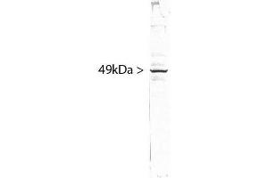 Image no. 2 for anti-Splicing Factor 3b, Subunit 4, 49kDa (SF3B4) antibody (ABIN1580459)