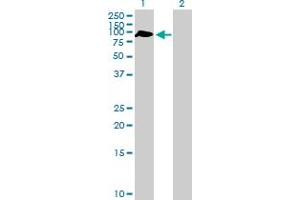 Image no. 1 for anti-Zinc Finger Protein 340 (ZNF340) (AA 1-589) antibody (ABIN530804)