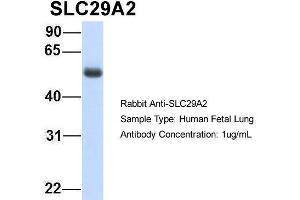 Image no. 3 for anti-Solute Carrier Family 29 (Nucleoside Transporters), Member 2 (SLC29A2) (C-Term) antibody (ABIN2781572)