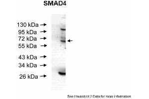 Image no. 3 for anti-SMAD Family Member 4 (SMAD4) (Middle Region) antibody (ABIN2779413)