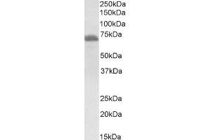Image no. 1 for anti-IL2-Inducible T-Cell Kinase (ITK) (Internal Region) antibody (ABIN1589997)