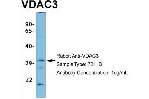 Image no. 4 for anti-Voltage-Dependent Anion Channel 3 (VDAC3) (N-Term) antibody (ABIN2776182)
