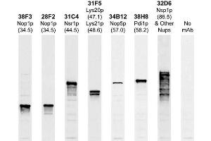 Image no. 1 for anti-Fibrillarin (FBL) antibody (ABIN1580417)