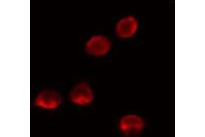 Image no. 3 for anti-Mediator Complex Subunit 26 (MED26) antibody (ABIN6257835)