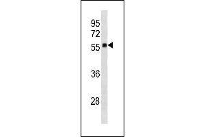 Image no. 1 for anti-Zinc Finger Protein 502 (ZNF502) (AA 75-101), (N-Term) antibody (ABIN1882028)