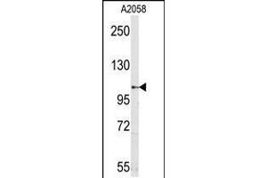 Image no. 1 for anti-Sema Domain, Seven thrombospondin Repeats (Type 1 and Type 1-Like), Transmembrane Domain (TM) and Short Cytoplasmic Domain, (Semaphorin) 5A (SEMA5A) (N-Term) antibody (ABIN5537512)