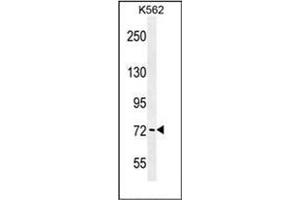 Image no. 1 for anti-P21-Activated Kinase 6 (PAK6) (AA 275-305), (Middle Region) antibody (ABIN953980)