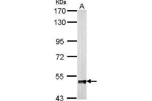 Image no. 5 for anti-4-Aminobutyrate Aminotransferase (ABAT) (Center) antibody (ABIN2854765)