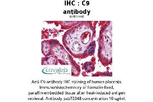 Image no. 2 for anti-Complement Component C9 (C9) (AA 184-411) antibody (ABIN1732510)