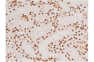 Image no. 2 for anti-Spleen tyrosine Kinase (SYK) (pTyr348) antibody (ABIN6255895)