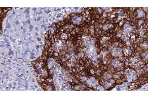 Image no. 2 for anti-Solute Carrier Family 4, Sodium Bicarbonate Cotransporter, Member 9 (SLC4A9) antibody (ABIN6265138)