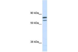 Image no. 1 for anti-Zinc Finger Protein, Multitype 1 (ZFPM1) (N-Term) antibody (ABIN2779910)