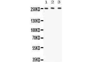 anti-ATP-Binding Cassette, Sub-Family A (ABC1), Member 1 (ABCA1) (AA 2231-2261), (C-Term) antibody
