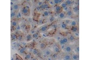 Image no. 2 for anti-Tumor Necrosis Factor Receptor Superfamily, Member 1B (TNFRSF1B) (AA 303-474) antibody (ABIN1174725)