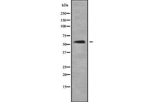 Image no. 1 for anti-Alanine Glyoxylate Aminotransferase 2 (AGXT2) (Internal Region) antibody (ABIN6259832)
