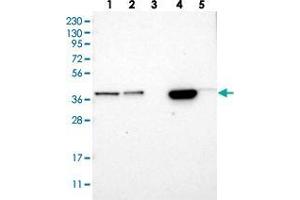 Image no. 2 for anti-Solute Carrier Family 35, Member E1 (SLC35E1) antibody (ABIN5588184)