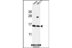 Image no. 1 for anti-Small Proline Rich Protein 1A (SPRR1A) (AA 61-89), (C-Term) antibody (ABIN653515)