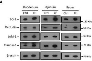 Image no. 3 for anti-Claudin 1 (CLDN1) antibody (ABIN3023187)