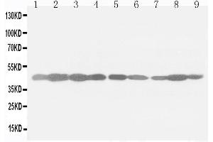 Image no. 1 for anti-Actin, beta (ACTB) (Cytosolic), (N-Term) antibody (ABIN3044484)