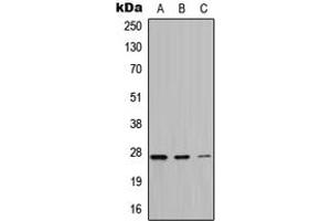 Image no. 1 for anti-Mitochondrially Encoded ATP Synthase 6 (MT-ATP6) (Center) antibody (ABIN2705544)