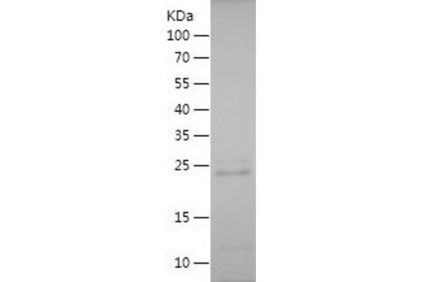 YAP1 Protein (AA 350-504) (His tag)