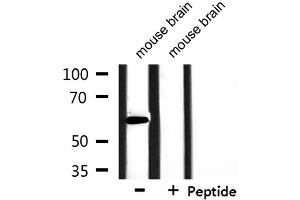 Image no. 2 for anti-Heterogeneous Nuclear Ribonucleoprotein L-Like (HNRPLL) (Internal Region) antibody (ABIN6258844)