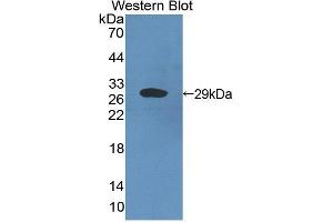 Image no. 1 for anti-Cysteine-Rich Secretory Protein 2 (CRISP2) (AA 22-240) antibody (ABIN1867383)