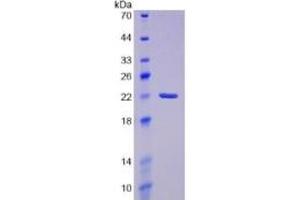 Image no. 2 for Prostaglandin D2 Synthase (PTGDS) ELISA Kit (ABIN6574195)