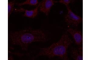 Image no. 1 for anti-RAB11A, Member RAS Oncogene Family (RAB11A) (C-Term) antibody (ABIN6254184)
