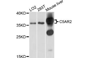 Image no. 2 for anti-G Protein-Coupled Receptor 77 (GPR77) antibody (ABIN4903091)