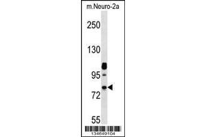 Image no. 1 for anti-NIMA-Related Kinase 8 (NEK8) (AA 519-547), (C-Term) antibody (ABIN657848)