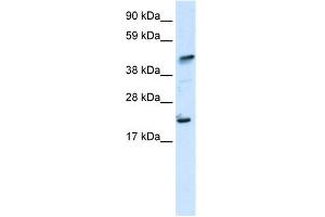 Image no. 2 for anti-IKAROS Family Zinc Finger 5 (Pegasus) (IKZF5) (N-Term) antibody (ABIN2777834)