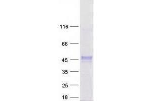 Image no. 1 for Zinc Finger Protein 784 (ZNF784) protein (Myc-DYKDDDDK Tag) (ABIN2736121)