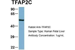 Image no. 3 for anti-Transcription Factor AP-2 gamma (Activating Enhancer Binding Protein 2 Gamma) (TFAP2C) (N-Term) antibody (ABIN2780497)