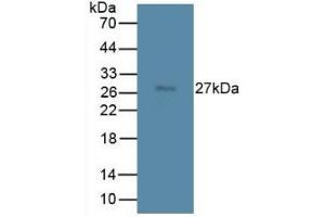Image no. 3 for Transmembrane Protein 27 (TMEM27) ELISA Kit (ABIN6720600)