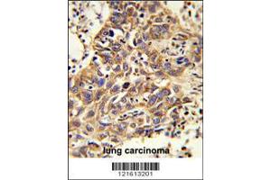Image no. 2 for anti-Catalase (CAT) (AA 152-180) antibody (ABIN652564)